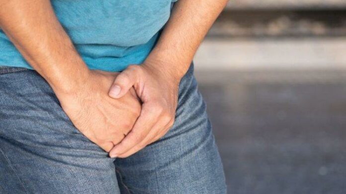 Varikokel, Penyebab Varikokel, Gejala Varikokel, Pengobatan Varikokel, Istilah Varikokel, Kesehatan, Penyakit Varikokel