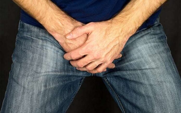 Varikokel, Penyakit Varikokel, Penyebab Varikokel, Pencegahan Varikokel, Kesehatan, Pria