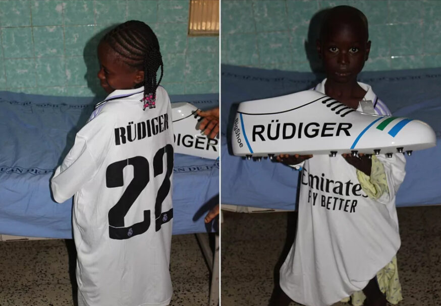 Rudiger, Jerman, Piala Dunia, Anak, Real Madrid, Disabilitas, Operasi, Piala Dunia Qatar 2022