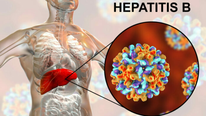 Hepatitis B