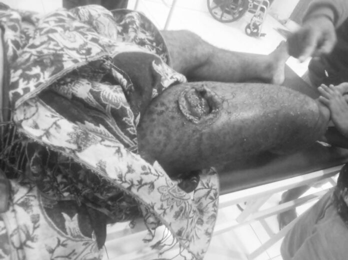 WhatsApp-Image-2026-06-15-at-04.58.05-e1781527954708 Yahukimo Papua, Pelajar tertembak, Dekai Yahukimo, Yustinus Yalak, Kali Biru, Distrik Sumohai, Papua Pegunungan, Kasus penembakan, Pelajar SMA