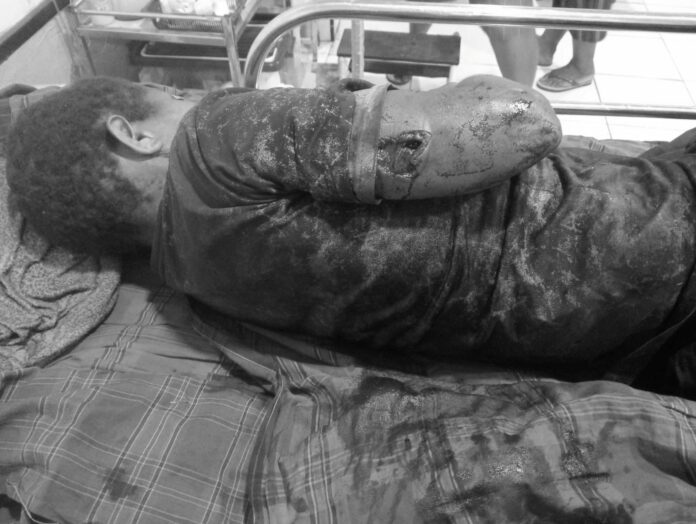 WhatsApp-Image-2026-06-18-at-18.12.56 Ledakan Danggoa, Intan Jaya, Distrik Agisiga, Korban Sipil, Papua Tengah, RSUD Sugapa, Aner Maisini