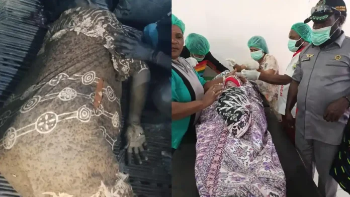 Seorang ibu hamil atas nama Melkiana Duwitau dengan usia kehamilan 7 bulan meninggal dunia bersamaan dengan anaknya masih dalam kandungan tewas setelah ditembak diduga dilakukan TNI di Intan Jaya